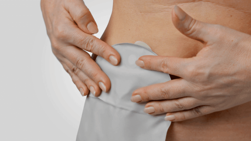 Pårørende til en med stomi: Slik bruker du Coloplast Norge for å støtte best mulig